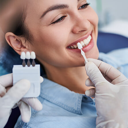 img-PAG-INTERNA-TRATTAMENTI-ESTETICI-02-Sbiancamenti-denti